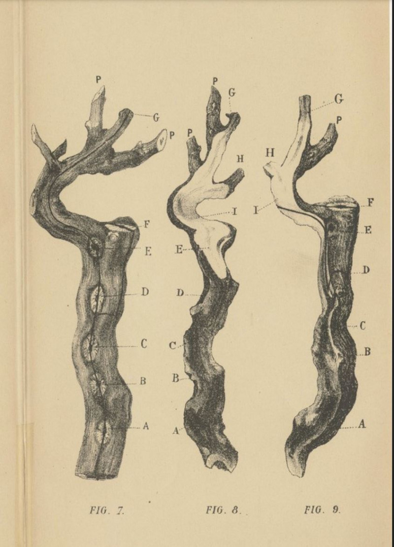 Caries Dezeimeris.JPG